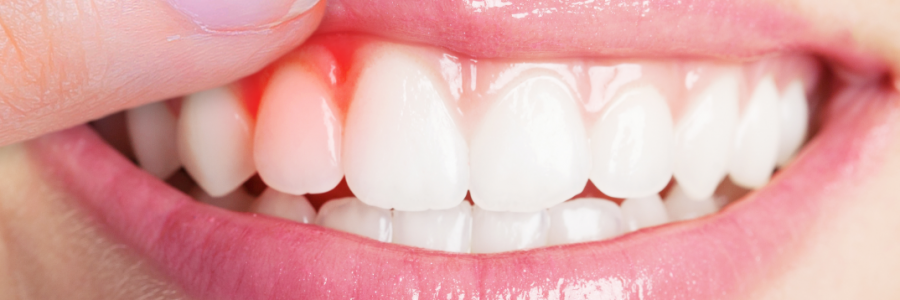 又上火又怕冷？上熱下寒、水火不濟，教你調(diào)回來！