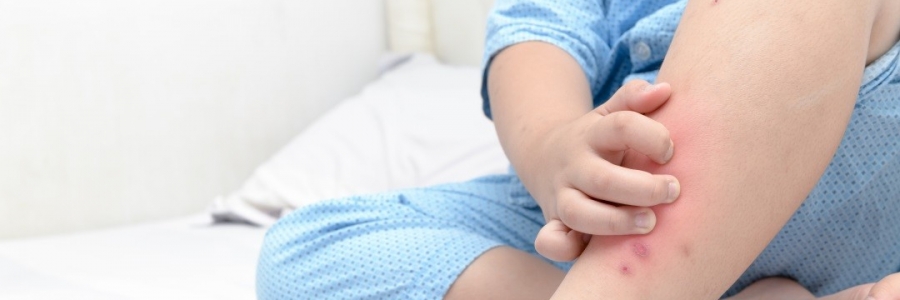 學古人這樣驅(qū)蚊，從此不再“蚊”風喪膽！