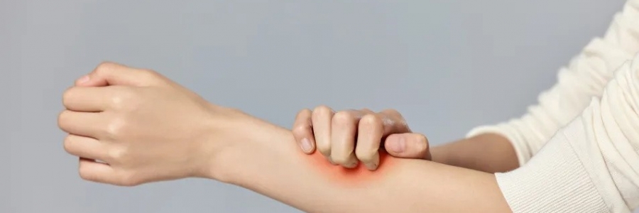 濕疹、瘙癢、蕁麻疹……患皮膚病，也許是好事！